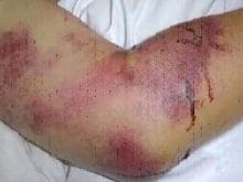 _8782464861 _8782464861