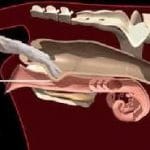 ineklerde-tohumlama_6