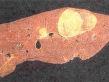 kucukbas19_clip_image006.jpg kucukbas19_clip_image006.jpg