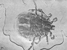 sigircilik24_clip_image014.jpg sigircilik24_clip_image014.jpg